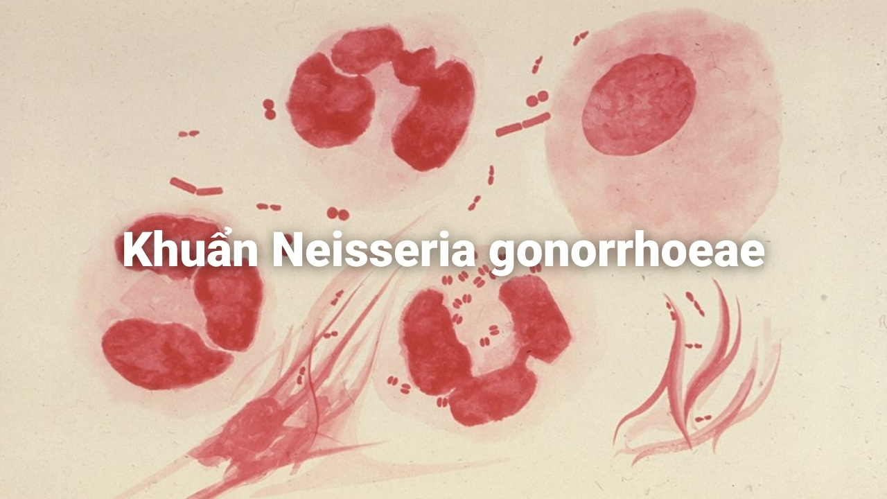 Bệnh lậu do Neisseria gonorrhoeae gây ra